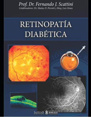 Libro: Retinopatía Diabética: Oftalmología (spanish Edition)