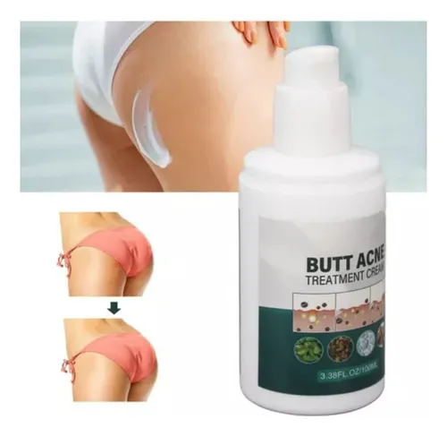 3×crema Para Granos En Gluteos, Tratamiento Limpieza