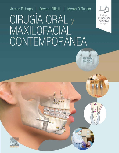 Hupp Cirugía Oral Y Maxilofacial Contemporánea 7ed/2020 Nuev