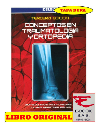 Conceptos En Traumatología Y Ortopedia/ Alfredo Martínez