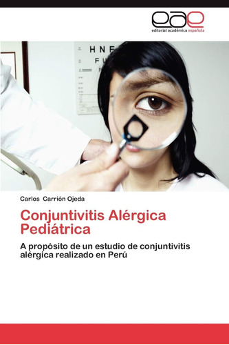 Libro: Conjuntivitis Alérgica Pediátrica: A Propósito De Un 