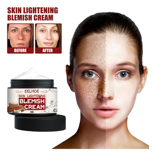L Crema Antipecas Para Aclarar Las Manchas Y Melanina Para A