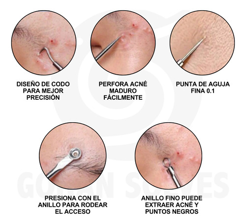 10 Kit 4 Removedores Puntos Negros Espinillas Rutina Facial