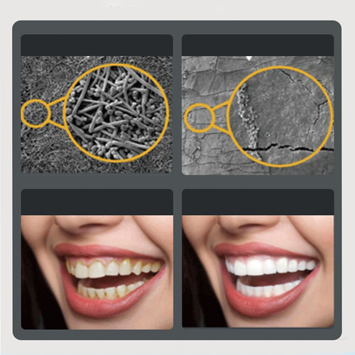 Cepillo De Dientes Limpiador Removedor De Sarro Raspador