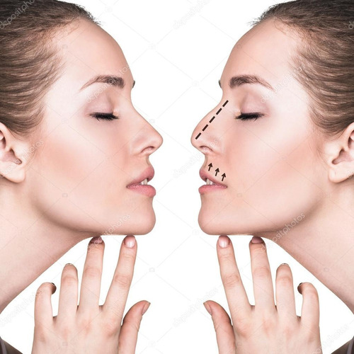 Respingada X Vida Corrector Nasal Externo Unisex Nose N Jmg