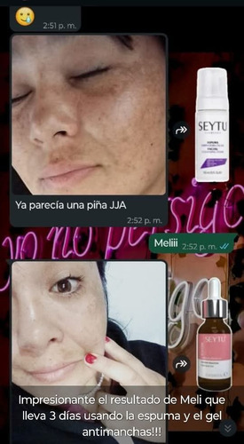 Kit Aclarador Anti Manchas Seytú X2