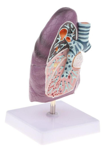 2: 3 Modelo De Anatomía Humana Enfermedad De Estructura