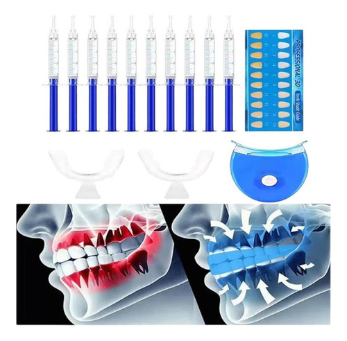 Kit Belleza Dental Protectores Bucales,lámpara Odontología