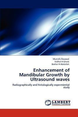 Enhancement Of Mandibular Growth By Ultrasound Waves - Mu...