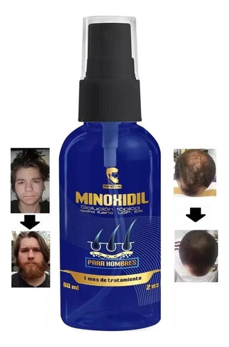 Frasco Minoxidil 5% Spray 60ml Minov136 Igual Kirkland Barba