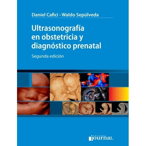 Ultrasonografía En Obstetricia Y Diagnóstico Prenatal 2º Ed.