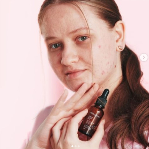 Hidrabene Sérum Blend Five Com 5 Ácidos Clareia Pele Oleosa