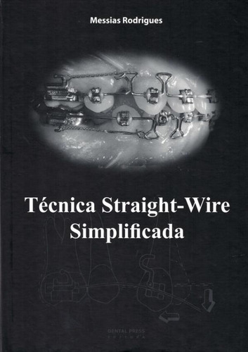 Tecnica Straight-wire Simplificada Versao Em Espanhol: Tecnica Straight-wire Simplificada Versao Em Espanhol, De Rodrigues, Messias. Editora Dental Press, Capa Dura, Edição 1 Em Espanhol, 2006