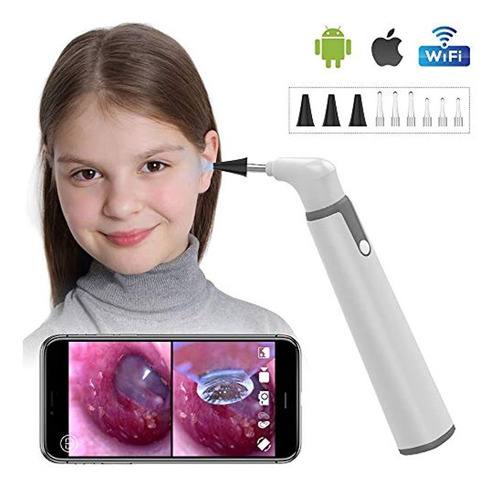 Otoscopio Inalámbrico Con Doble Vista, 0.154 in, 720phd, Wif