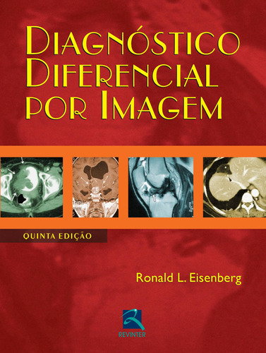 Diagnóstico Diferencial por Imagem, de Eisenberg, Ronald L.. Editora Thieme Revinter Publicações Ltda, capa dura em português, 2015