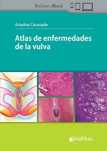 Atlas De Enfermedades De La Vulva. Caussade