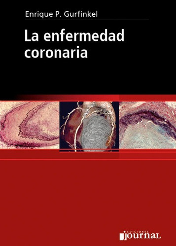 La Enfermedad Coronaria, De Gurfinkel., Vol. No Aplica. Editorial Journal, Tapa Blanda En Español, 2008