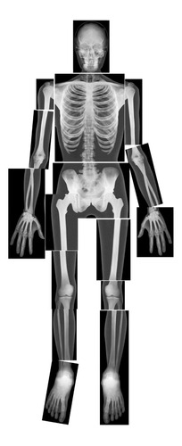 True To Life Human Xrays