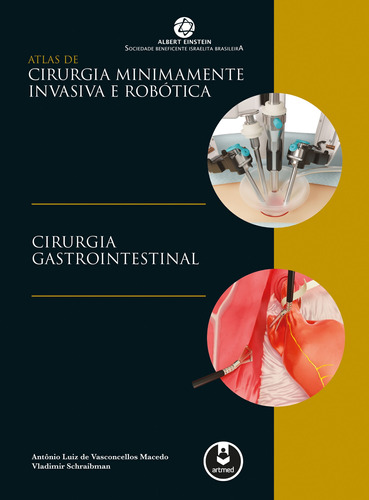 Atlas de Cirurgia Minimamente Invasiva e Robótica: Cirurgia Gastrointestinal, de Macedo, Antônio V.. Artmed Editora Ltda., capa mole em português, 2017