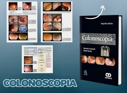 Colonoscopia 2 Ed Averbach,jk