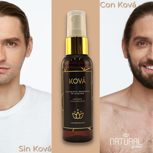 Imagen 7 de 9 de Minoxidil 5% Tratamiento Para Cabello Y Barba 60ml