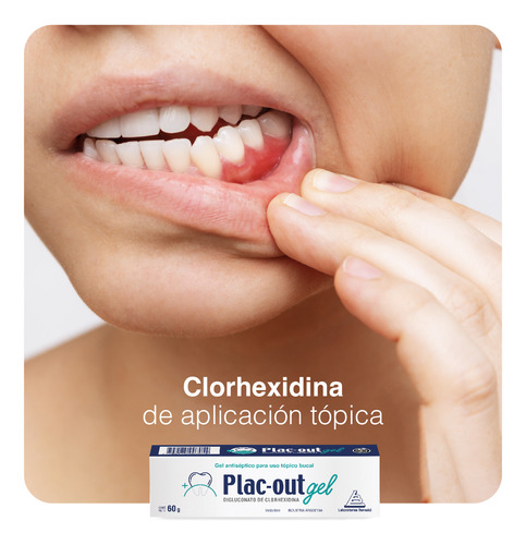 Bernabó Plac-out Gel Antiseptico Bucal X 60g