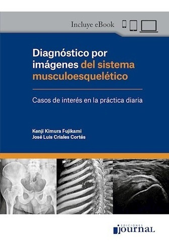 Diagnóstico Por Imágenes Del Sistema Musculoesquelético 