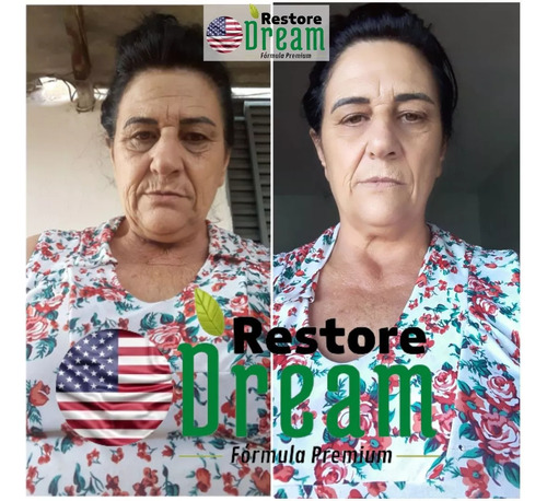 Trans-resveratrol Americano Rejuvenescedor - Restoredream