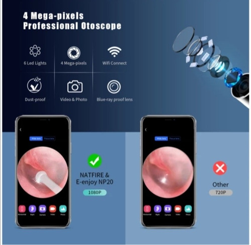 Imagen 8 de 10 de Otoscopio Digital Wifi iPhone Android, Limpieza Oidos