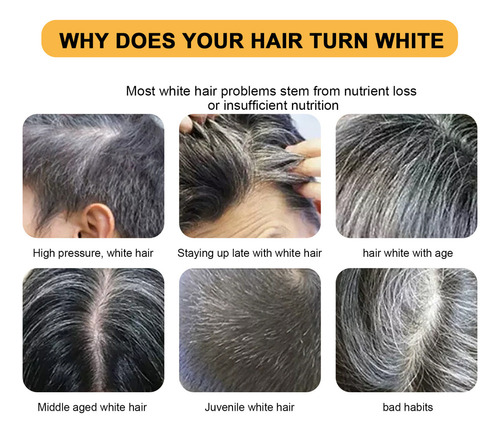 Barra De Sabão Para Escurecimento De Cabelo De 4 Peças