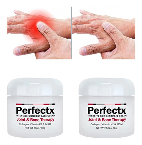 2 Pomadas Para Tratar La Artritis Muscular De La Rodilla M