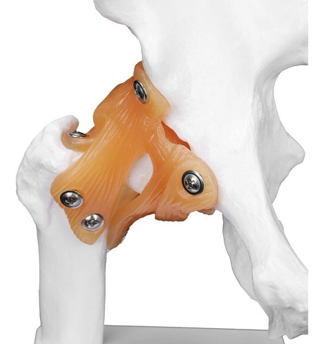 Imagen 4 de 7 de Modelo Articulación De Cadera