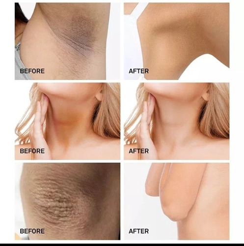 Crema Blanqueadora Para Las Partes Íntimas