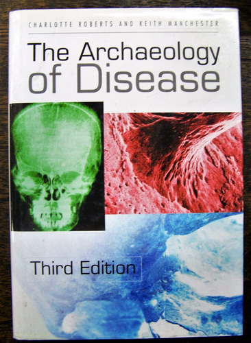 Imagen 1 de 6 de The Archaeology Of Disease * Charlotte Roberts K. Manchester