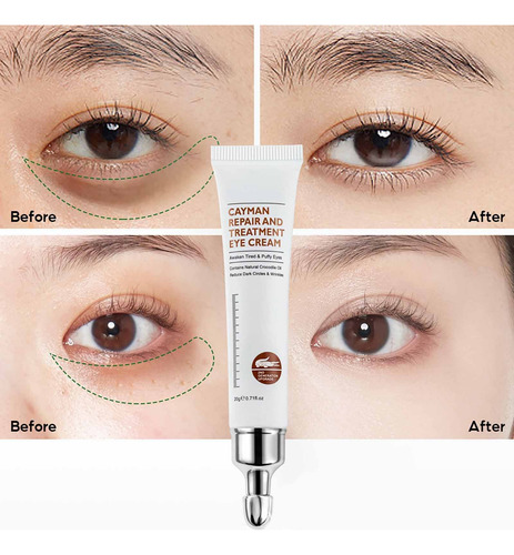 Crema Hidratante Para Ojos X Wrinkle Eye CĂrculos Oscuros Ag