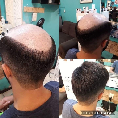 Imagen 3 de 5 de Cinta Para Prótesis Capilares Lace Front De 3 Yardas, Walker