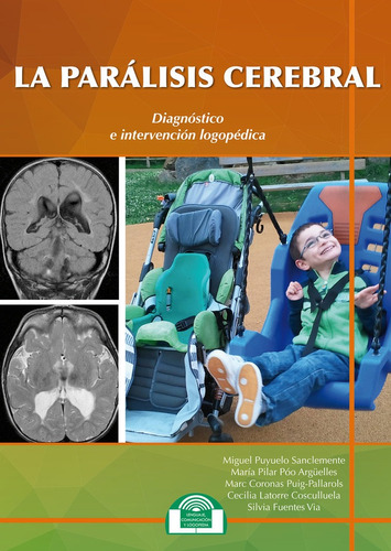 Paralisis Cerebral Diagnostico E Intervencion Logopedic -...