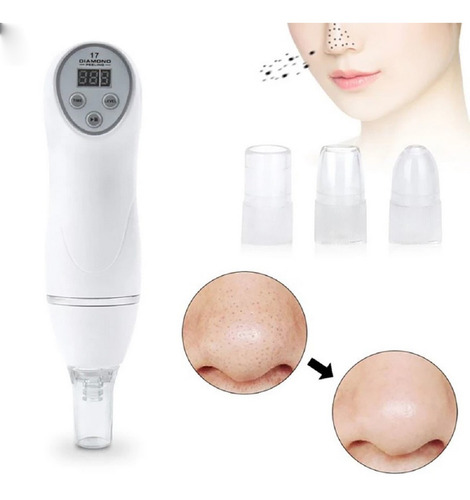 Limpiador Facial Microdermoabrasion Puntas De Diamante