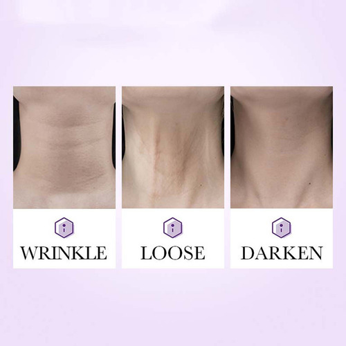 Crema De Estiramiento Y Estiramiento De Cuello Q Roller Type