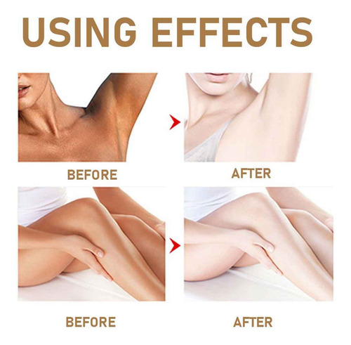 Crema Blanqueadora De Piel Crema Aclaradora Para Zonas Íntim