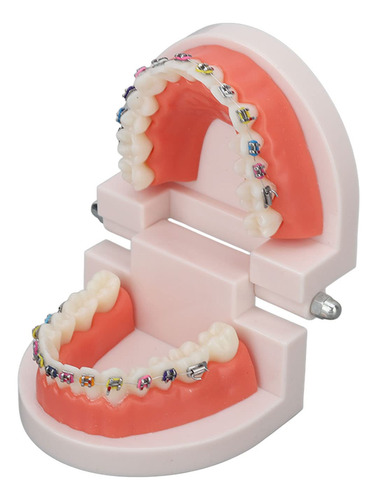 Modelo De Dientes De Ortodoncia Con Soportes De Metal De