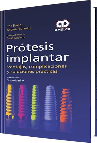 Prótesis Implantar Ventajas Complicaciones Y Soluciones