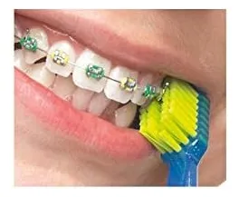 Curaprox Ortho Kit, Versión Comercial