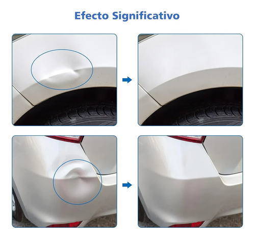 Kit Ventosa Saca Golpes De Auto De Ventosa Abolladuras 77pcs