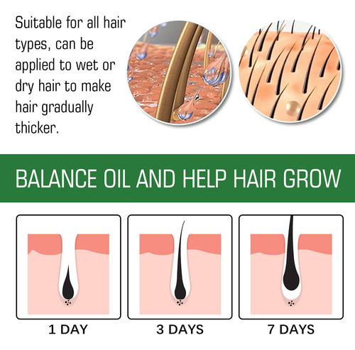 Eelhoe Aceite De Romero Set Tratamiento Para Cabello Seco