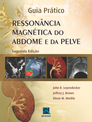 Ressonância Magnética do Abdome e da Pelve, de Leyendecker, John R.. Editora Thieme Revinter Publicações Ltda, capa dura em português, 2015
