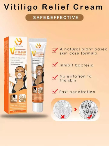 Crema Tratamiento Profesional Para Eliminar El Vitiligo Original