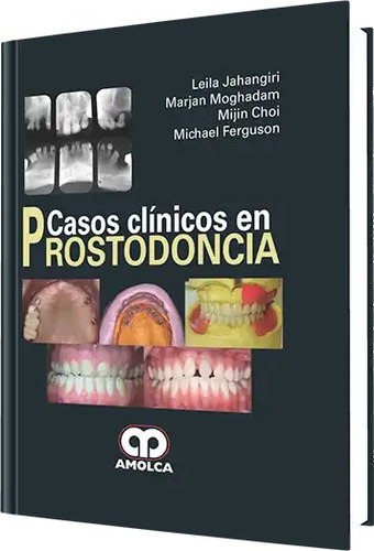 Casos Clínicos En Prostodoncia