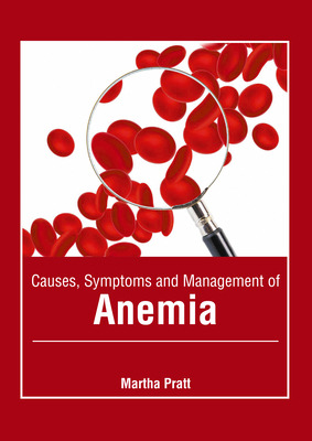 Libro Causes, Symptoms And Management Of Anemia - Pratt, ...