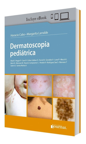 Dermatoscopia Pediatrica